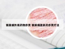 银屑病外用药物序贯 银屑病激素药序贯疗法