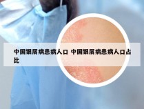 中国银屑病患病人口 中国银屑病患病人口占比