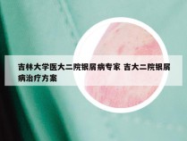 吉林大学医大二院银屑病专家 吉大二院银屑病治疗方案