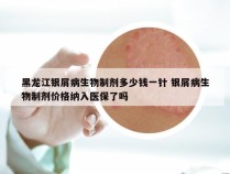 黑龙江银屑病生物制剂多少钱一针 银屑病生物制剂价格纳入医保了吗