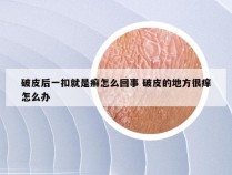 破皮后一扣就是癣怎么回事 破皮的地方很痒怎么办