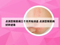 点滴型银屑病三个月开始消退 点滴型银屑病好转迹象