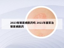 2023有银屑病新药吗 2021年国家治银屑病新药