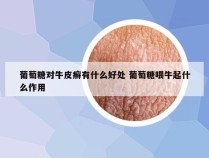 葡萄糖对牛皮癣有什么好处 葡萄糖喂牛起什么作用