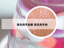 徐文兵牛皮癣 徐文兵牛肉