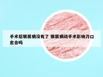 手术后银屑病没有了 银屑病动手术影响刀口愈合吗