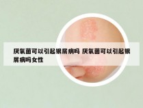 厌氧菌可以引起银屑病吗 厌氧菌可以引起银屑病吗女性