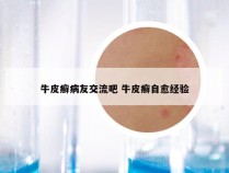 牛皮癣病友交流吧 牛皮癣自愈经验