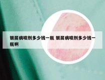 银屑病喷剂多少钱一瓶 银屑病喷剂多少钱一瓶啊