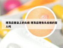 理发店里染上的头癣 理发店理有头皮癣的客人吗