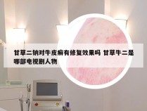 甘草二钠对牛皮癣有修复效果吗 甘草牛二是哪部电视剧人物