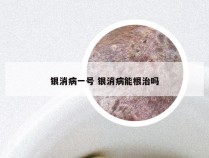 银消病一号 银消病能根治吗