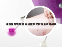 延边医院银屑病 延边医院皮肤科坐诊时间表