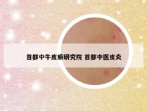 首都中牛皮癣研究院 首都中医皮炎