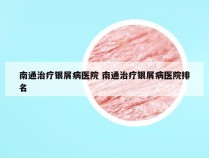 南通治疗银屑病医院 南通治疗银屑病医院排名