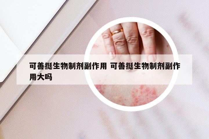 可善挺生物制剂副作用 可善挺生物制剂副作用大吗