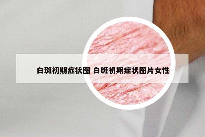 白斑初期症状图 白斑初期症状图片女性
