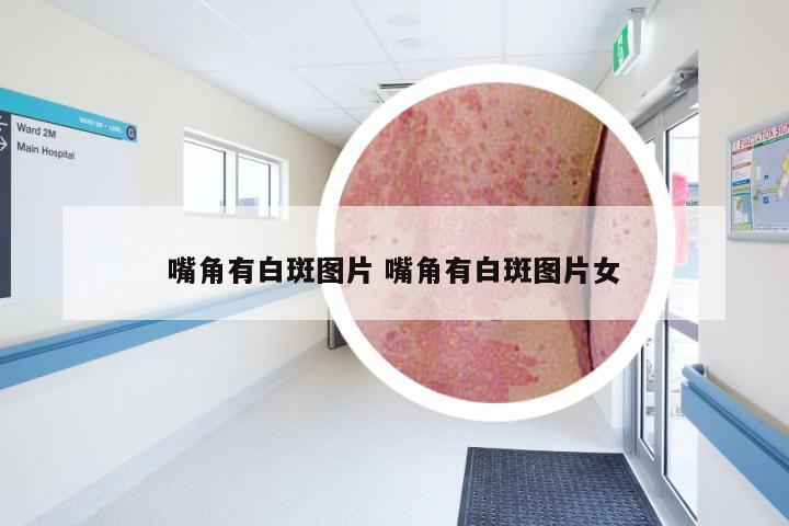嘴角有白斑图片 嘴角有白斑图片女