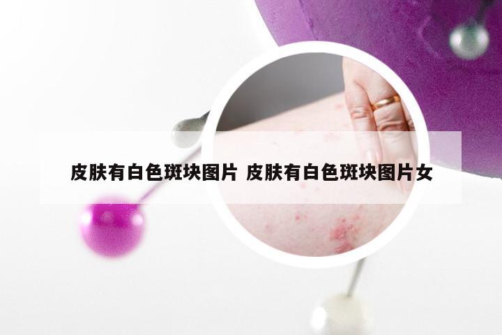 皮肤有白色斑块图片 皮肤有白色斑块图片女