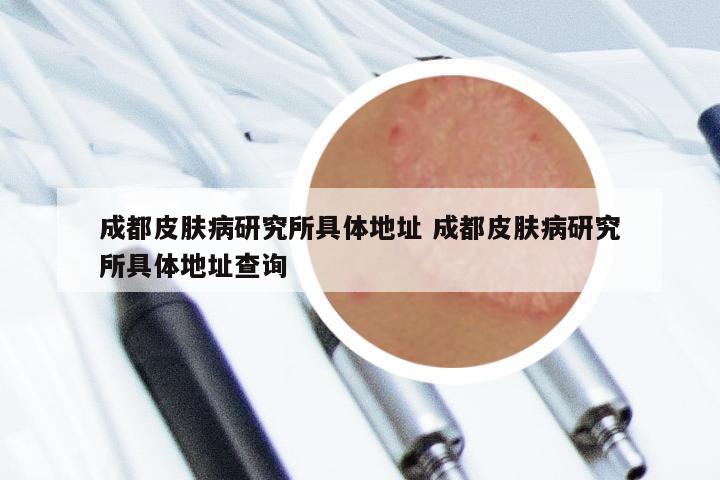 成都皮肤病研究所具体地址 成都皮肤病研究所具体地址查询