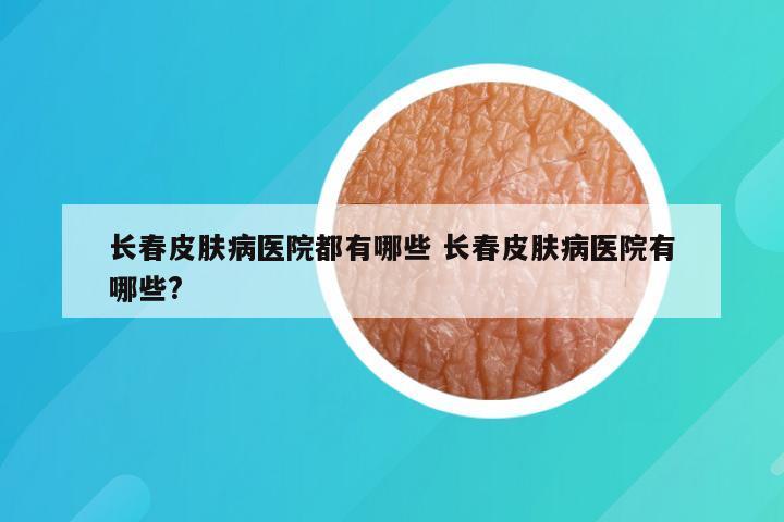 长春皮肤病医院都有哪些 长春皮肤病医院有哪些?