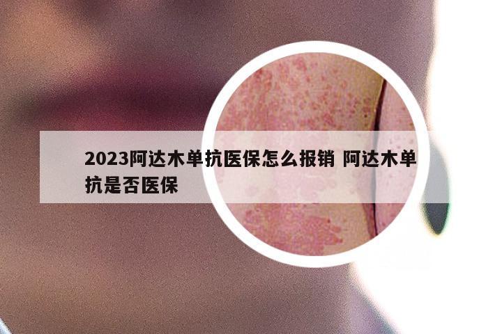 2023阿达木单抗医保怎么报销 阿达木单抗是否医保