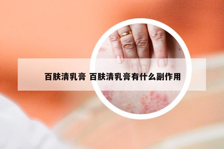 百肤清乳膏 百肤清乳膏有什么副作用