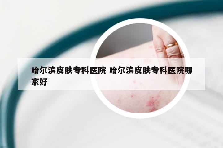 哈尔滨皮肤专科医院 哈尔滨皮肤专科医院哪家好