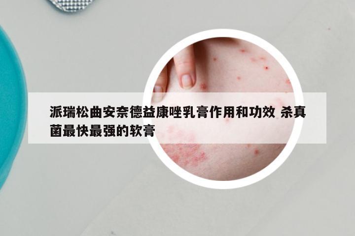派瑞松曲安奈德益康唑乳膏作用和功效 杀真菌最快最强的软膏