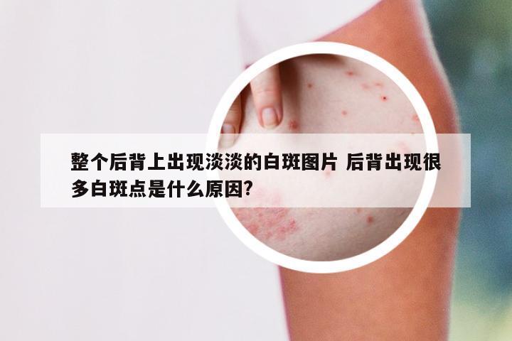 整个后背上出现淡淡的白斑图片 后背出现很多白斑点是什么原因?