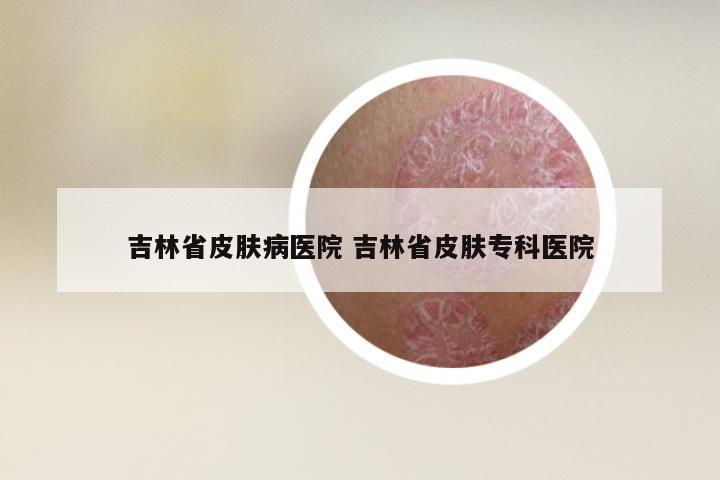吉林省皮肤病医院 吉林省皮肤专科医院