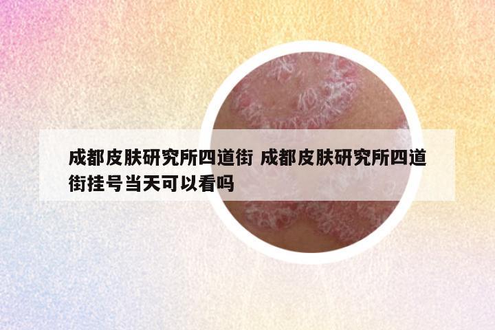 成都皮肤研究所四道街 成都皮肤研究所四道街挂号当天可以看吗
