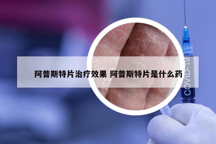 阿普斯特片治疗效果 阿普斯特片是什么药