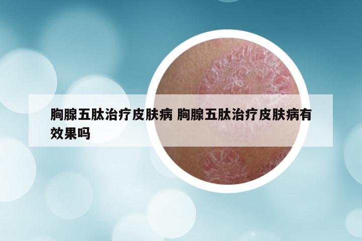 胸腺五肽治疗皮肤病 胸腺五肽治疗皮肤病有效果吗