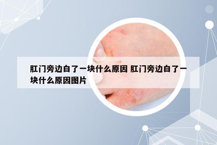 肛门旁边白了一块什么原因 肛门旁边白了一块什么原因图片