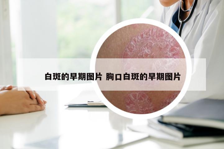 白斑的早期图片 胸口白斑的早期图片