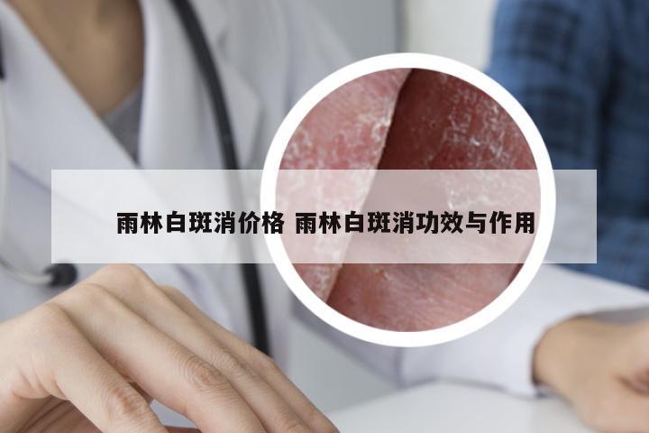 雨林白斑消价格 雨林白斑消功效与作用