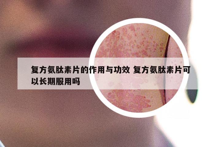 复方氨肽素片的作用与功效 复方氨肽素片可以长期服用吗