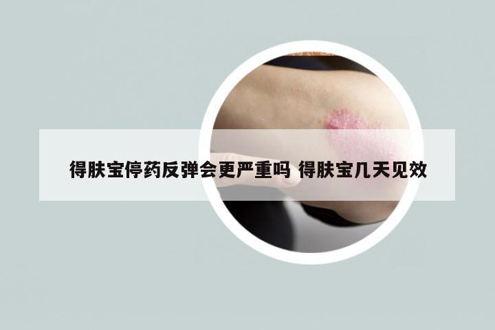 得肤宝停药反弹会更严重吗 得肤宝几天见效