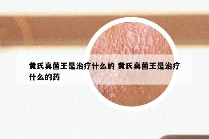 黄氏真菌王是治疗什么的 黄氏真菌王是治疗什么的药