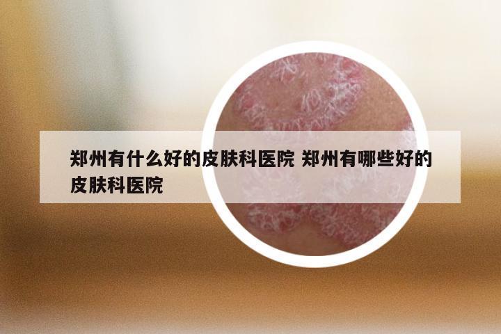 郑州有什么好的皮肤科医院 郑州有哪些好的皮肤科医院