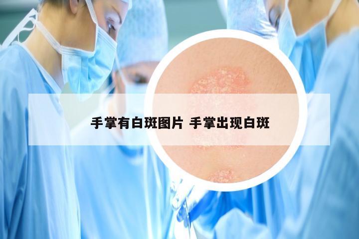 手掌有白斑图片 手掌出现白斑
