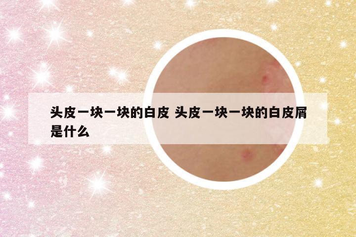头皮一块一块的白皮 头皮一块一块的白皮屑是什么