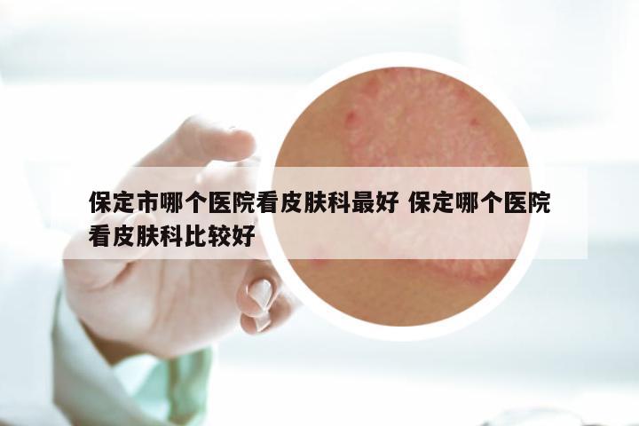 保定市哪个医院看皮肤科最好 保定哪个医院看皮肤科比较好