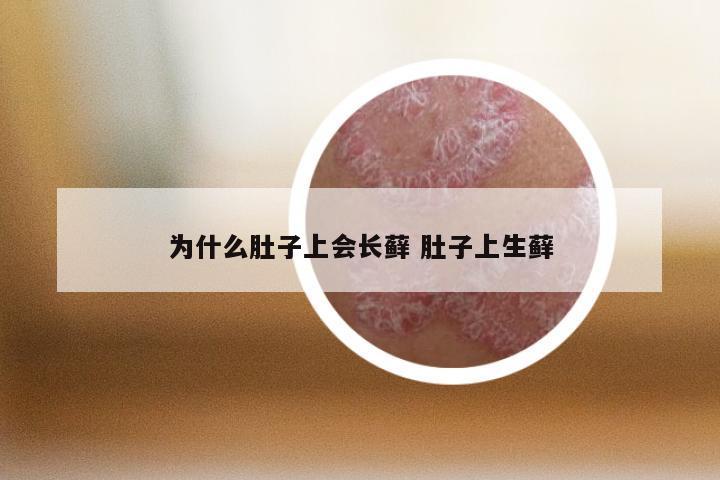 为什么肚子上会长藓 肚子上生藓