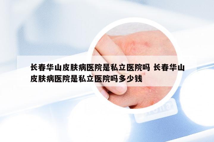 长春华山皮肤病医院是私立医院吗 长春华山皮肤病医院是私立医院吗多少钱