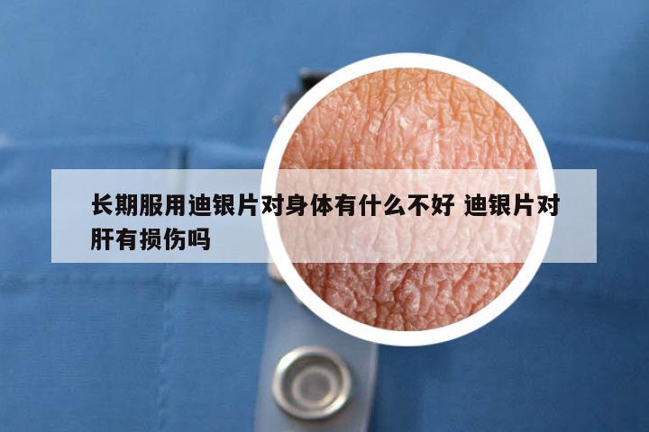 长期服用迪银片对身体有什么不好 迪银片对肝有损伤吗