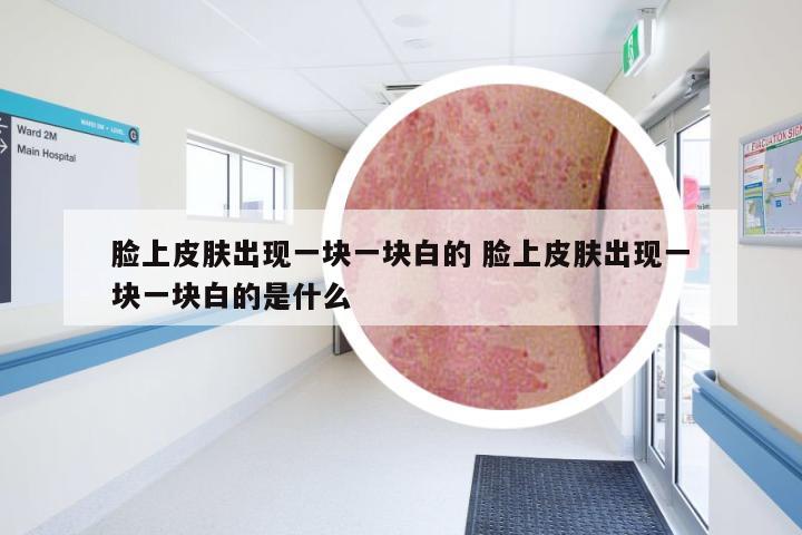脸上皮肤出现一块一块白的 脸上皮肤出现一块一块白的是什么