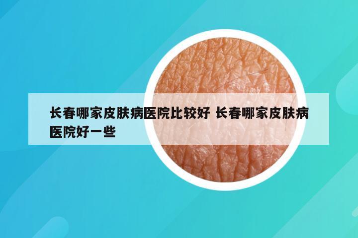 长春哪家皮肤病医院比较好 长春哪家皮肤病医院好一些