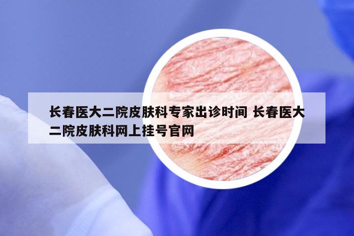 长春医大二院皮肤科专家出诊时间 长春医大二院皮肤科网上挂号官网